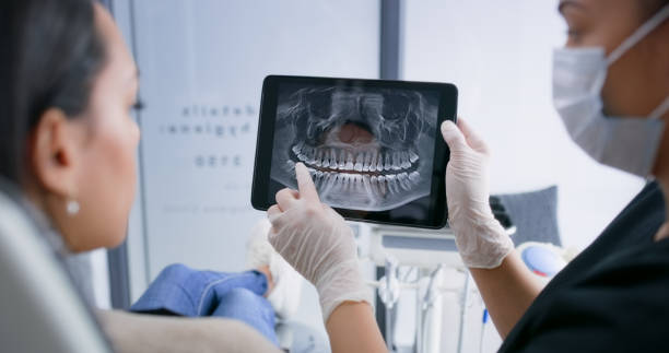 Licensed Tooth Extraction service in Beverly Hills, CA - Smile Center Dentistry